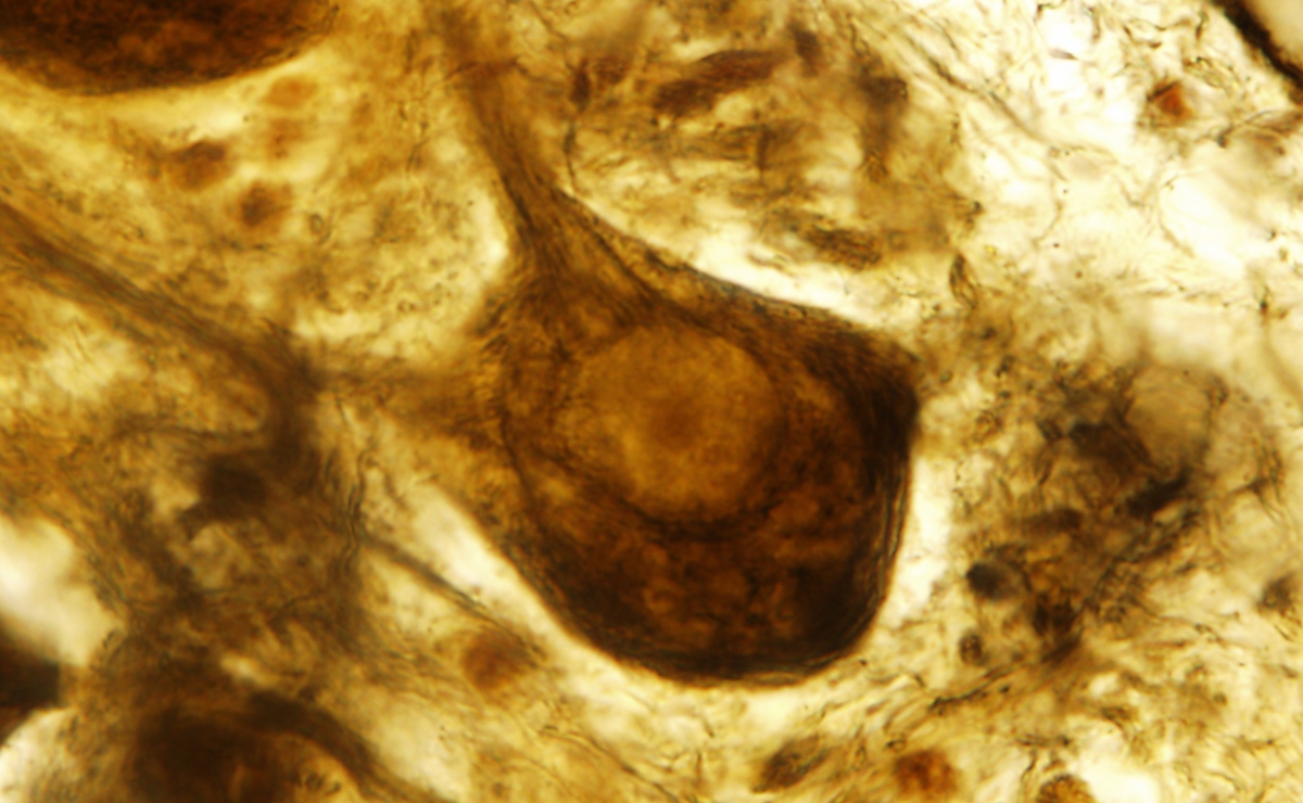 Luis Simarro Lacabra (1851-1921) y la microfotografía 
