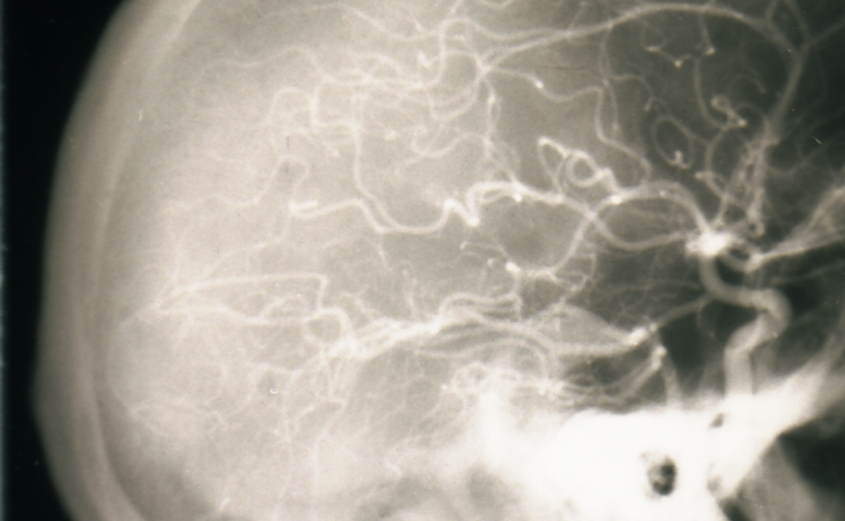  Neurorradiología, Electroencefalografía, Electromiografía 